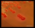 escherichia coli